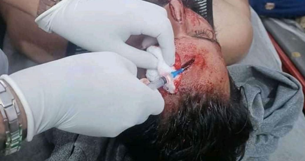 एमयूका विद्यार्थीमाथि  प्रहरीको दमन 